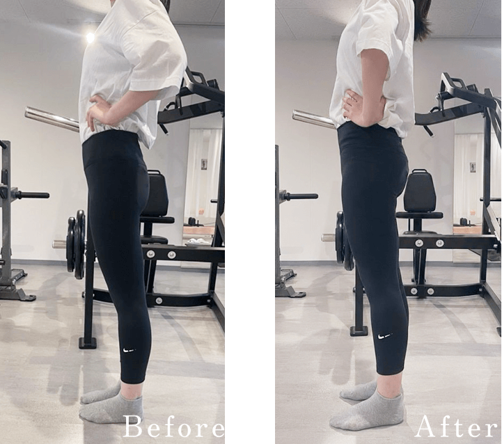 O・SさんBefore&After