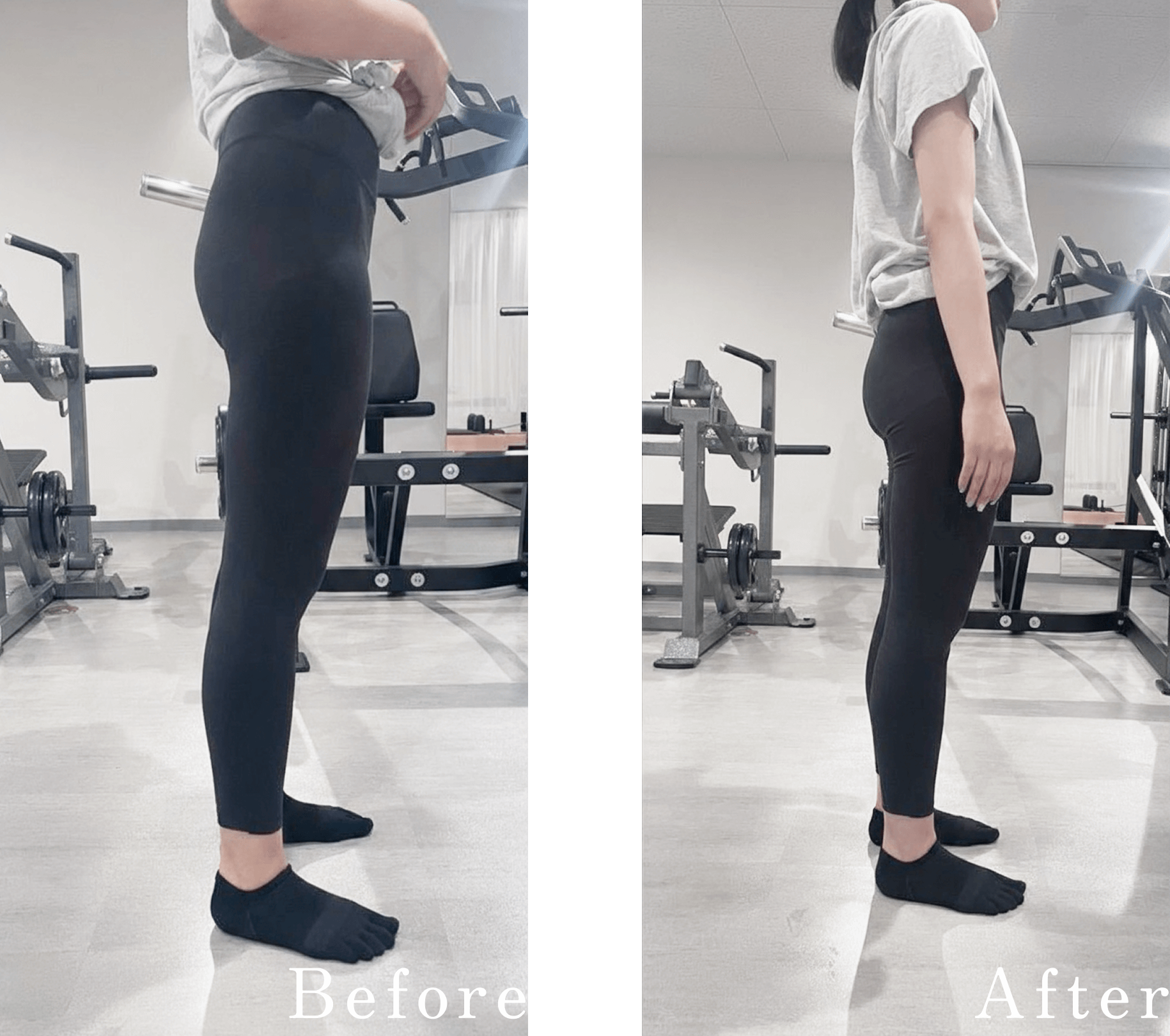 S・TさんBefore&After